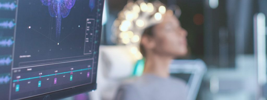 tDCS-Neuromodulación ¿Qué es?
