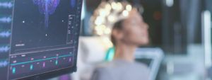 tDCS-Neuromodulación ¿Qué es?