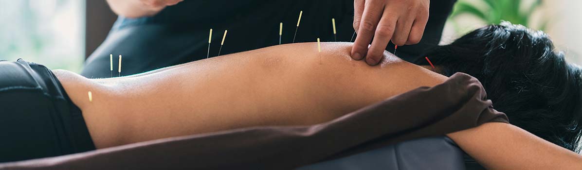 Acupuntura
